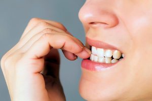 Closeup of patient biting their nails