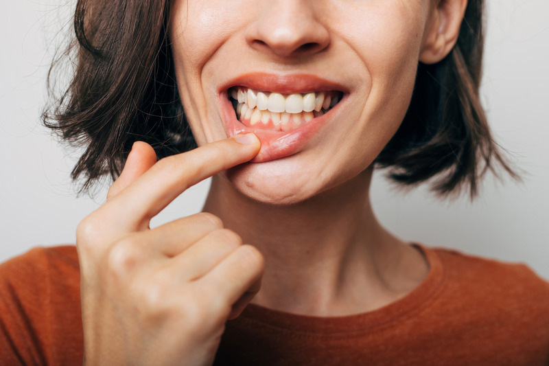 Patient smiling with their porcelain veneers